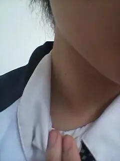 我17岁,女生,右锁骨上方淋巴结肿 大如拇指甲盖大小