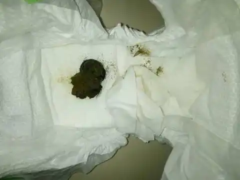 宝宝便便是黑色一坨的