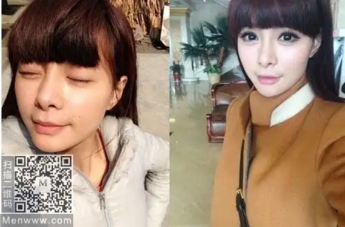沈梦辰整容对比照