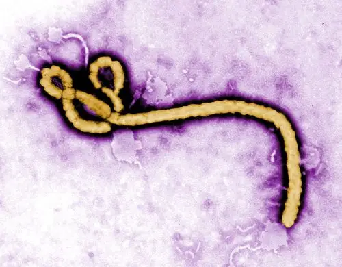 congos ebola outbreak reports 1st confirmed urban case