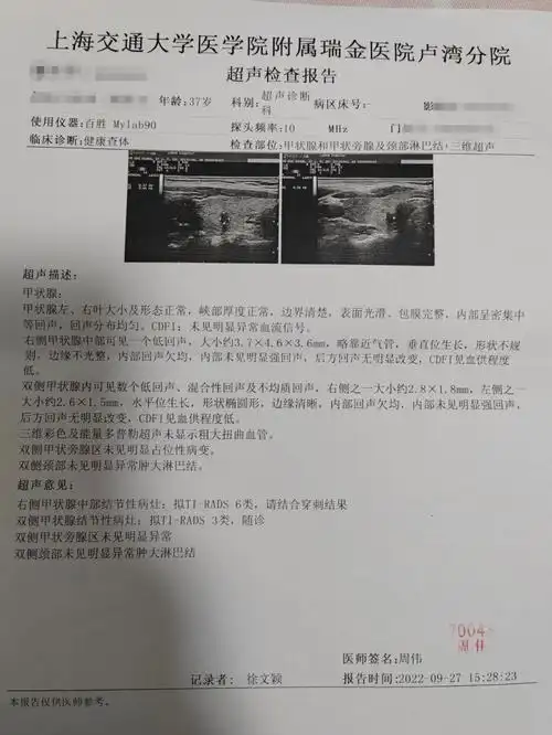 甲状腺三家医院三次超声
