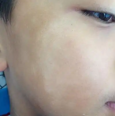 其他癣专家_其他治疗癣哪个专家好_其他治疗癣最好的