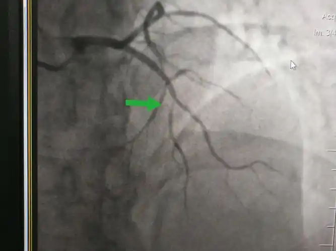 炎炎夏日,心痉则凉 - 美篇