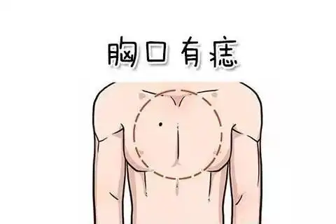 胎记长在胸口意味着什么胸口长痣有什么含义