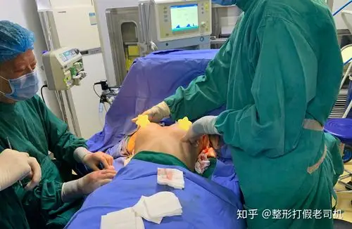 隆胸方式有哪些小姐姐自述假体隆胸过程