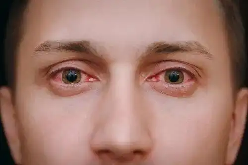 2中国人是黄皮肤,黑眼睛.