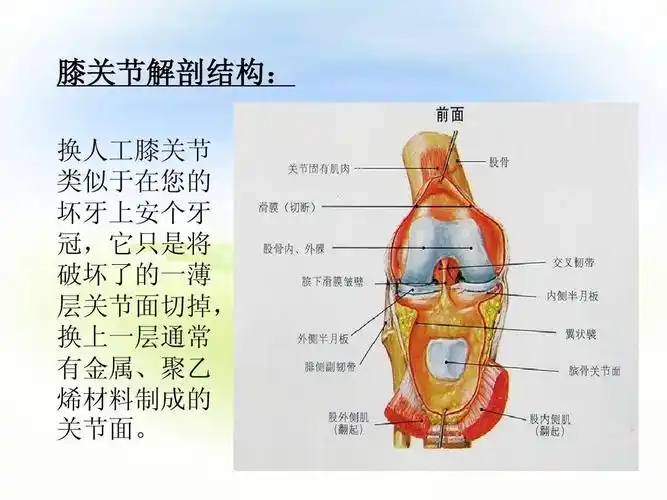 人工膝关节术后健康教育