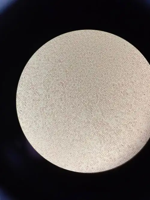 这张是没有染色的红细胞,在现场看到和被拍成照片还是有区别的.