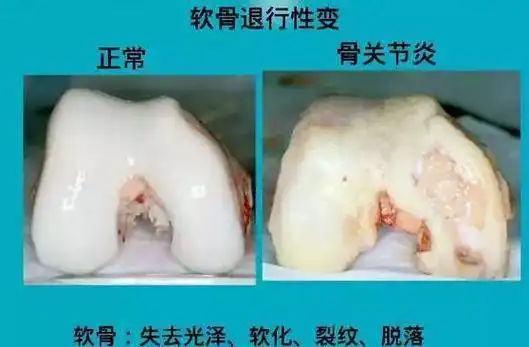 肌肉|髌骨|髋关节|人工膝关节_网易订阅