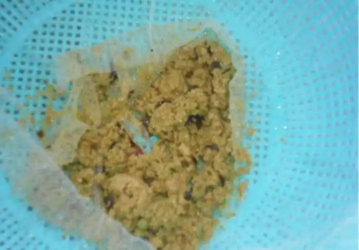 p>泥沙性胆结石是一种胆色素性结石,它的成分主要是胆红素,所以质脆