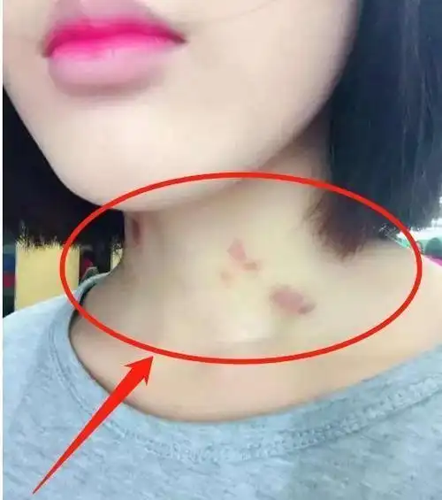 10岁女儿脖子上出现"草莓印",女儿道出实情后,爸爸愧疚流泪