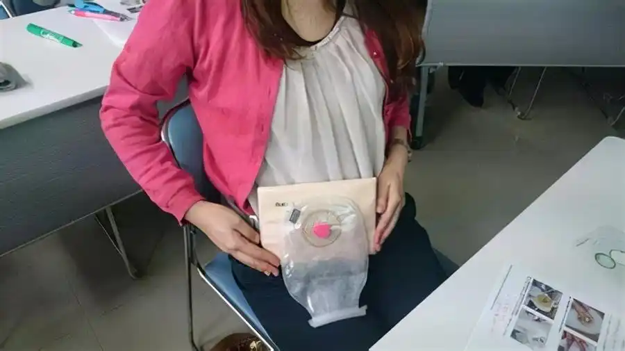 直肠癌放疗一次多少钱直肠癌