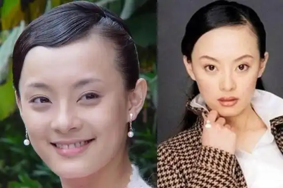 "颅顶低"的8位女星,不敢梳贴头皮发型,个个头顶似"平房"|刘海|脸型|发