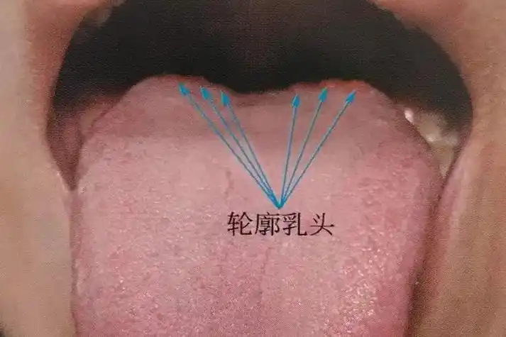 轮廓乳头疙瘩图