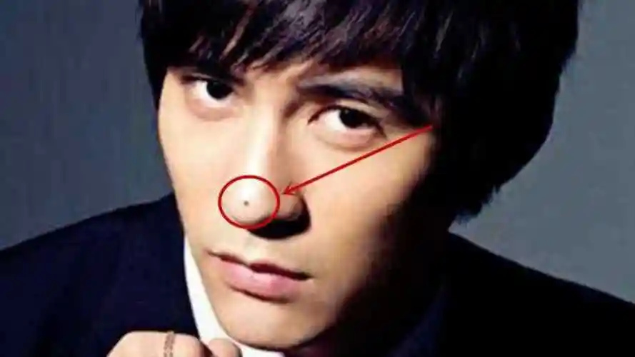 鼻子上有这种痣的男人注定事业有成财运当头看看有你吗