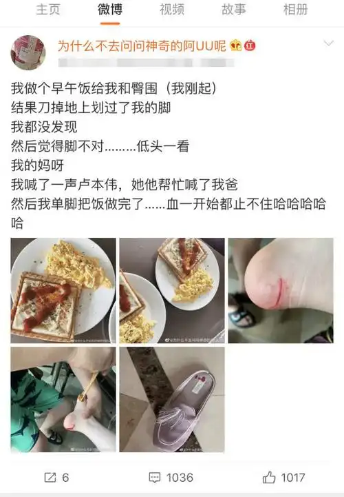 赵梦玥做饭不小心把脚割伤看到卢本伟的反应赵梦玥彻底寒心了