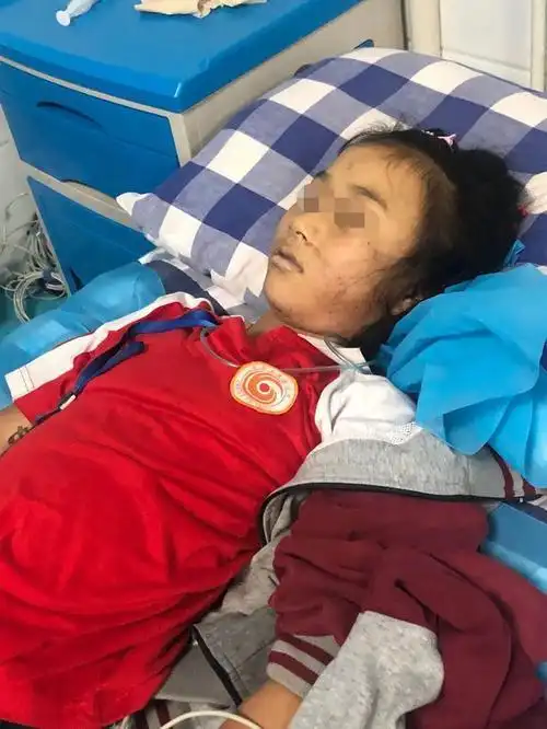 四川10岁女孩遭老师罚跪打手板后昏迷送院抢救后不治身亡