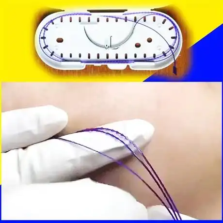 强生倒刺线线雕鱼骨线效果