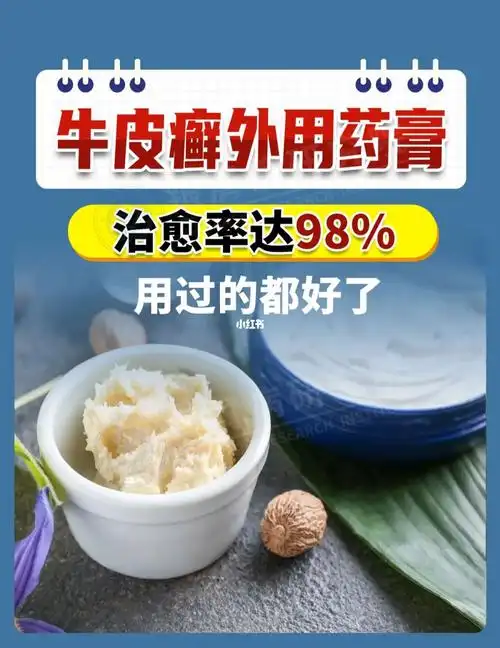 绝绝子银屑病外用药膏6015用过的都好了6015