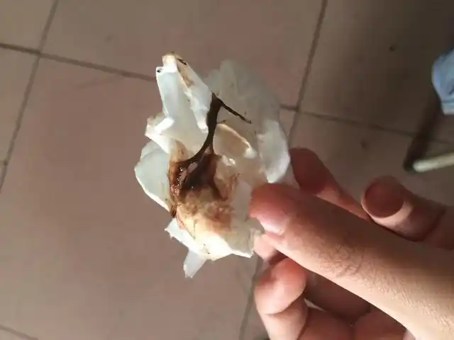 "宫颈癌"不疼不痒?一旦有这"3症状",是子宫在"求救"