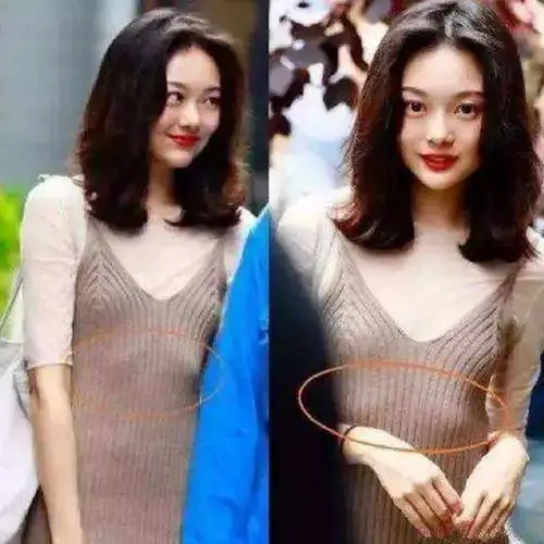 分享937815肋骨外翻还会影响我们的呼吸变的短浅,膈肌没能更好