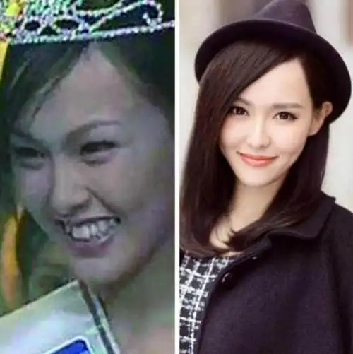 原来唐嫣也有这么无法入眼的时期?