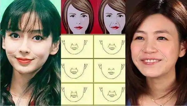 你现在 是不是已经知道如何消除和 印堂纹竖纹悬针纹双雀纹八字纹川字