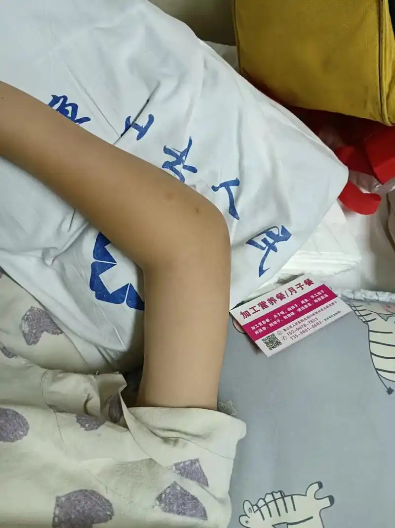 孩子右肘关节骨折,虽然是个小手术,但需要全麻,等在手术室外两 - 抖音