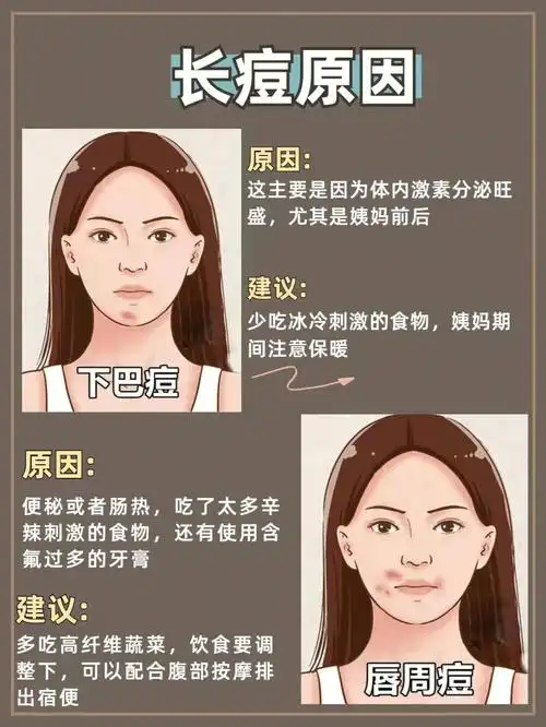 脸上不同位置长痘痘原因60该如何护理71