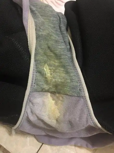 内裤精斑和分泌物区别 - 搜狗图片搜索