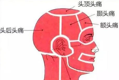 因此,因头部经络功能失常例如气血失调,头部脉络不通导致的头痛可通过