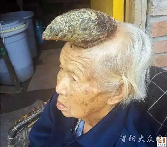 安岳老人头上长角