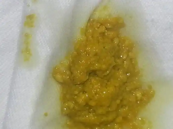 追问 这是蛋花样便吗? 回答 婴儿粪便呈黄色或