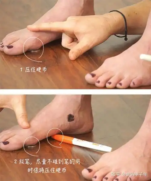 正常的足部受力方式.