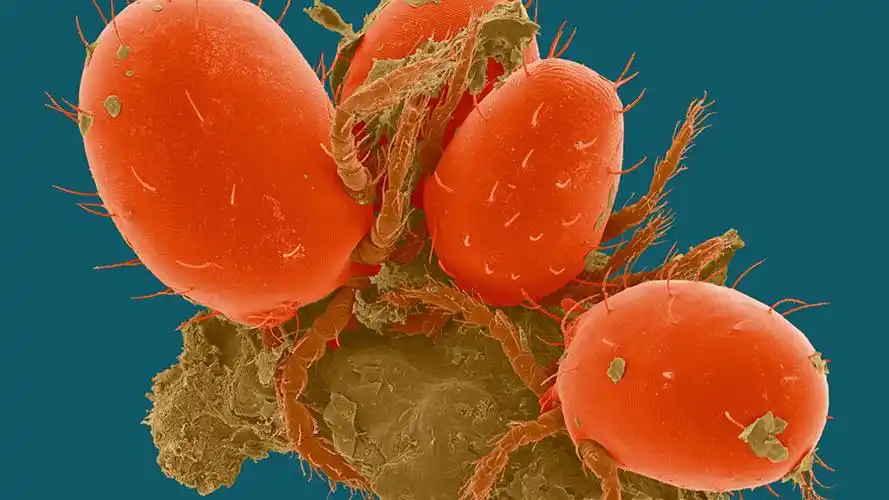 鲜艳惊悚英科学家公布一组寄生虫显微照片6