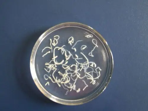 高原之殇-虫癌 脑包虫病例分享