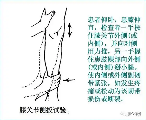 跟腱损伤检查3.踝部前抽屉试验