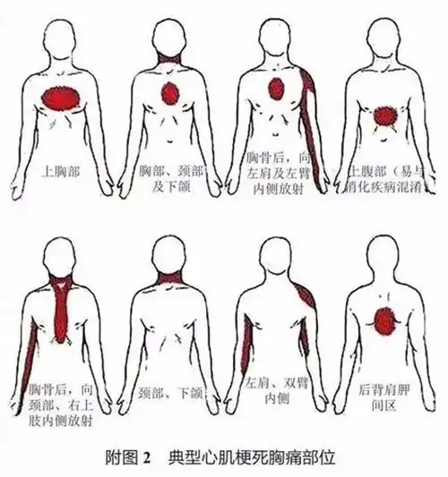 发现心梗火速拨打120抢救黄金时间120分钟