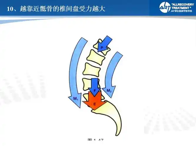 腰椎间盘突出治疗思路与影像分析 二