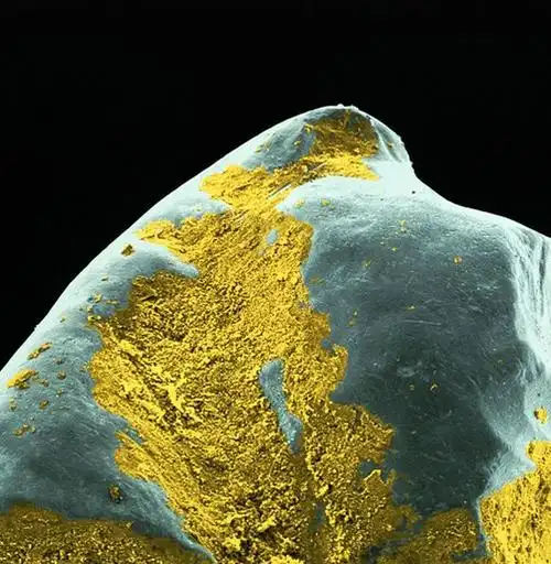 高清实拍电子显微镜下毛骨悚然的牙齿细菌4