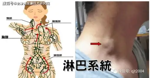 颈部淋巴不通危害这么大不用刮痧板不用罐就能搞定