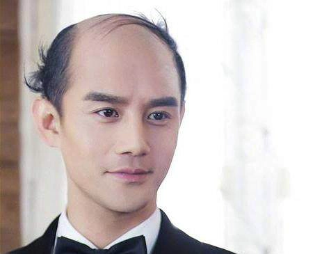 当红男星秃顶照你们心中的男神变成这样最后这位帅气不减|秃顶|当红
