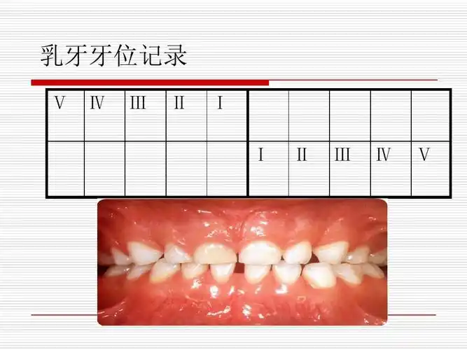 乳牙牙位记录 Ⅴ Ⅳ Ⅲ Ⅱ Ⅰ Ⅰ Ⅱ Ⅲ Ⅳ Ⅴ