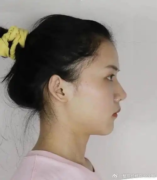 真的是我的理想型,鼻型完美