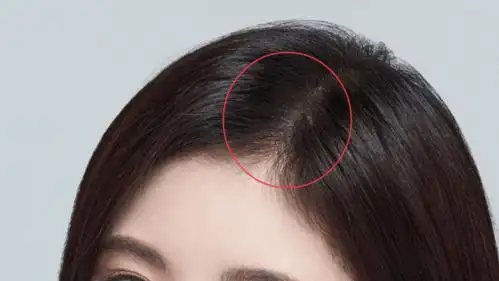 原来发缝暗藏"心机",这也太精致了_头发