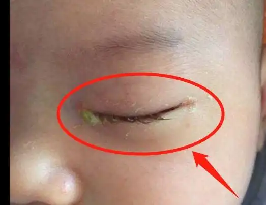 小儿百病积食为先家长注意学会这几招或消积食健脾胃