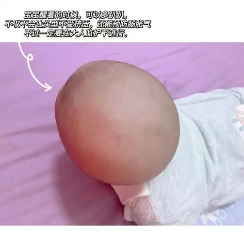 所以一直很重视给宝宝睡头型,大宝已经两岁半,标准的大圆头,(图5)带