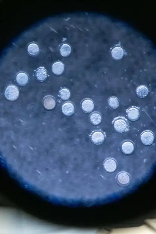 显微镜下的卵母细胞.