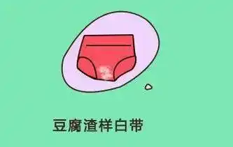 下面流黄水,豆腐渣腥味.好烦啊,怎么办?_阴道_检查_病菌