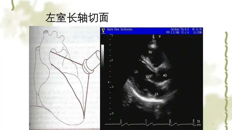 心脏超声标准切面及测量ppt课件